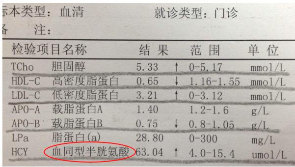 除了“三高”，還要小心這一高——同型半胱氨酸（Hcy）
